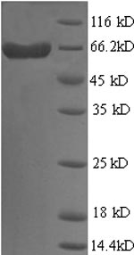 Recombinant Human Galectin-9(LGALS9)