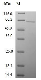 Recombinant Human Gamma-1-syntrophin(SNTG1)