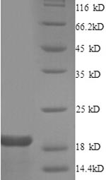 Recombinant Human Gap junction alpha-1 protein(GJA1),partial