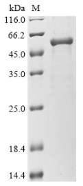 Recombinant Human Gasdermin-D(GSDMD)