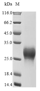 Recombinant Human Gastric inhibitory polypeptide receptor(GIPR),partial