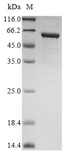 Recombinant Human Gastric inhibitory polypeptide receptor(GIPR),partial,Biotinylated