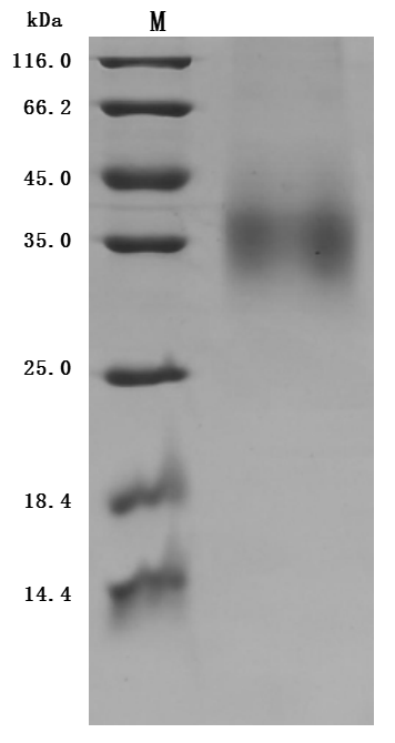 Recombinant Human Glucagon receptor(GCGR),partial (Active)