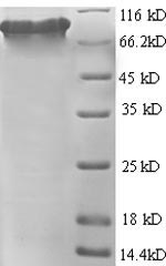 Recombinant Human Glutamate carboxypeptidase 2(FOLH1),partial