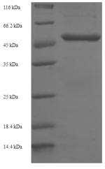 Recombinant Human Glutaminyl-peptide cyclotransferase(QPCT)