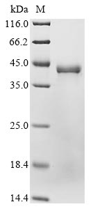 Recombinant Human Glutaminyl-peptide cyclotransferase(QPCT)