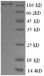 Recombinant Human Glycogen phosphorylase, brain form(PYGB),partial