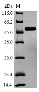 Recombinant Human Glycogen synthase kinase-3 beta(GSK3B)
