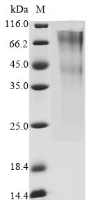 Recombinant Human Glypican-3(GPC3)(G537R),partial (Active)