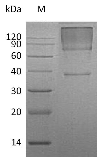 Recombinant Human Glypican-3(GPC3),partial (Active)