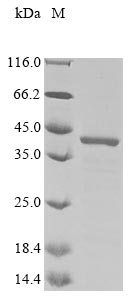 Recombinant Human Golgi phosphoprotein 3(GOLPH3)