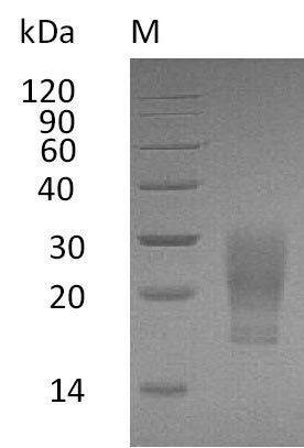 Recombinant Human Granulocyte-macrophage colony-stimulating factor(CSF2) (Active)