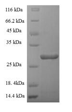 Recombinant Human Granulocyte-macrophage colony-stimulating factor(CSF2)