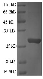 Recombinant Human Granzyme B(GZMB)