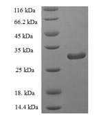 Recombinant Human Group IID secretory phospholipase A2(PLA2G2D),partial