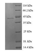 Recombinant Human Growth/differentiation factor 9(GDF9)