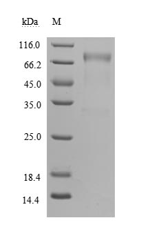 Recombinant Human Growth hormone receptor(GHR),partial (Active)