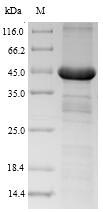 Recombinant Human Growth hormone receptor(GHR),partial