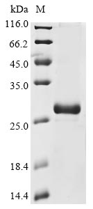Recombinant Human Guanylate cyclase soluble subunit alpha-2(GUCY1A2),partial