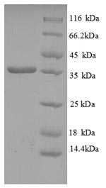 Recombinant Human HLA-C protein(HLA-C),partial