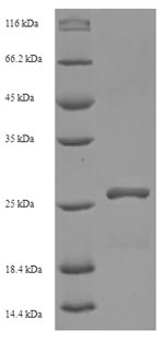 Recombinant Human HLA-DMA protein(HLA-DMA),partial