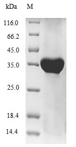 Recombinant Human HLA class I histocompatibility antigen, alpha chain G(HLA-G)