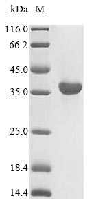 Recombinant Human HLA class I histocompatibility antigen,A-1 alpha chain(HLA-A),partial