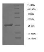 Recombinant Human HLA class II histocompatibility antigen, DP beta 1 chain(HLA-DPB1),partial