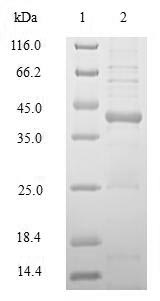 Recombinant Human HLA class II histocompatibility antigen, DRB1-1 beta chain(HLA-DRB1),partial