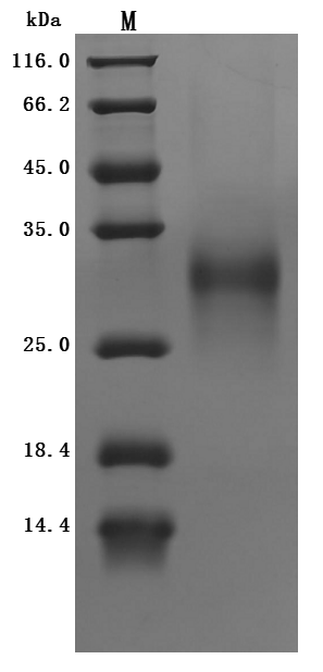 Recombinant Human HLA class II histocompatibility antigen gamma chain(CD74),partial (Active)