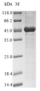 Recombinant Human Haptoglobin(HP)