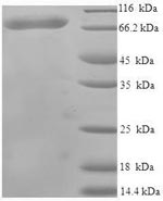 Recombinant Human Harmonin(USH1C)