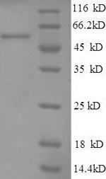 Recombinant Human Heat shock protein 75 kDa, mitochondrial(TRAP1),partial