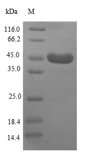 Recombinant Human Heat shock protein HSP 90-alpha(HSP90AA1),partial