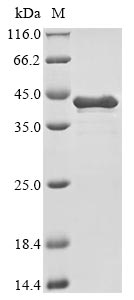 Recombinant Human Heat shock protein HSP 90-alpha(HSP90AA1),partial