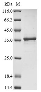 Recombinant Human Heat shock protein HSP 90-alpha(HSP90AA1),partial