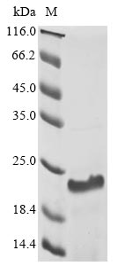 Recombinant Human Heat shock protein HSP 90-alpha(HSP90AA1),partial