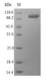 Recombinant Human Heat shock protein HSP 90-beta(HSP90AB1)
