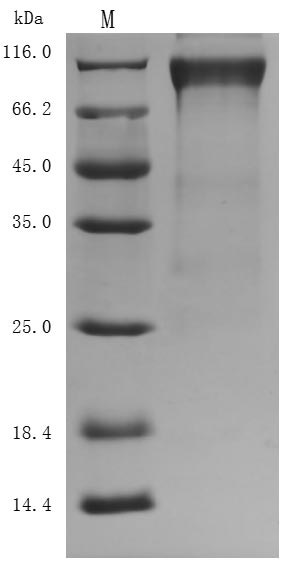 Recombinant Human Heat-stable enterotoxin receptor(GUCY2C),partial (Active)