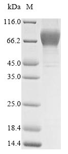 Recombinant Human Heat-stable enterotoxin receptor(GUCY2C),partial (Active)