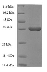 Recombinant Human Heme oxygenase 1(HMOX1),partial