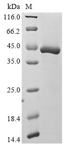 Recombinant Human Hemoglobin subunit delta(HBD)