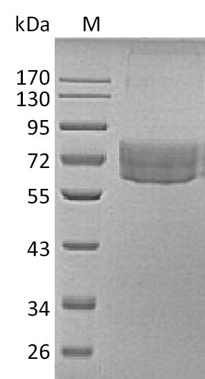 Recombinant Human Hepatitis A virus cellular receptor 2(HAVCR2),partial (Active)