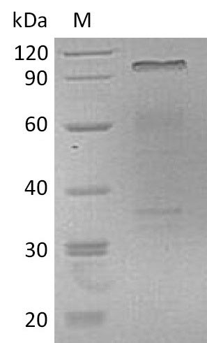 Recombinant Human Hepatocyte growth factor(HGF) (Active)