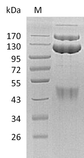 Recombinant Human Hepatocyte growth factor receptor(MET),partial (Active)