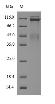 Recombinant Human Hepatocyte growth factor receptor(MET),partial (Active)