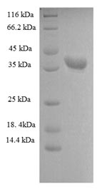 Recombinant Human Heterogeneous nuclear ribonucleoprotein A1(HNRNPA1),partial