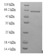 Recombinant Human Heterogeneous nuclear ribonucleoprotein H(HNRNPH1)