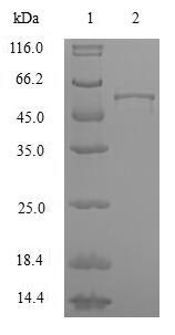 Recombinant Human Heterogeneous nuclear ribonucleoproteins A2/B1(HNRNPA2B1)