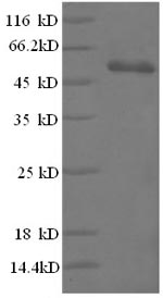 Recombinant Human High mobility group protein B1(HMGB1),partial